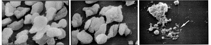 der Apoptoseninduktion